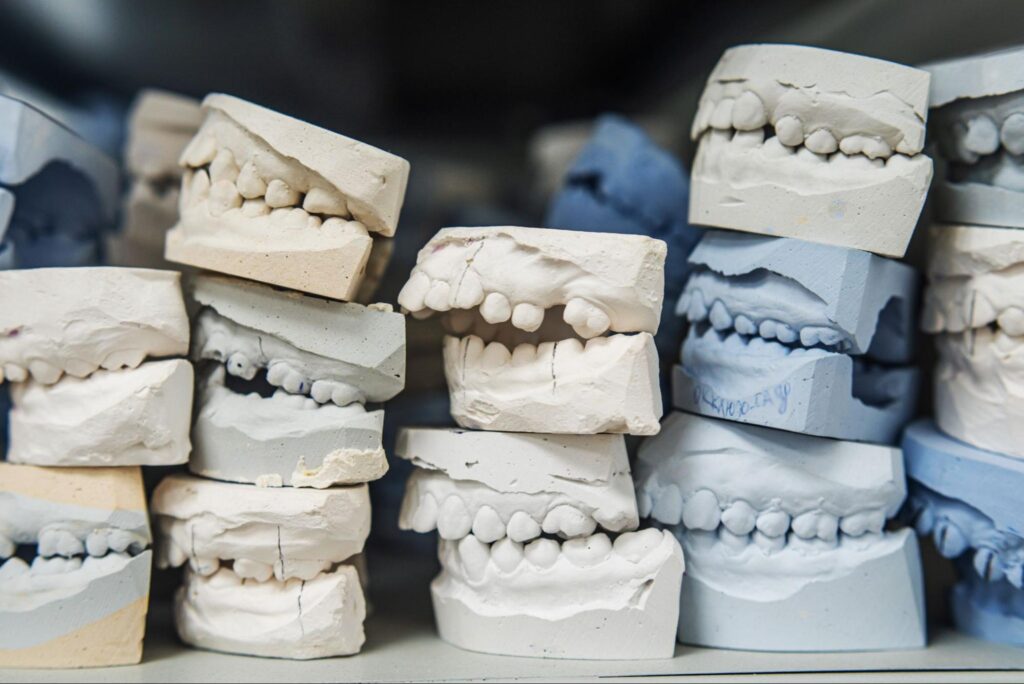 矯正歯科 種類
